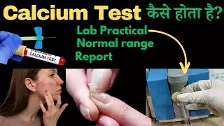 Calcium Blood Test Kaise Hota Hai | Calcium Test in Hindi | Lab Practical || DMLT || BMLT