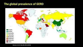 GERDX Device in the treatment of GERD disease. (Endo Orbit Live Session 25.FEB.2024)