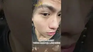 ĐIỀU TRỊ MỤN Đ&Oacute;N GI&Aacute;NG SINH #hoaianhplusbeauty #hoaianhspa #hoaianh #dieutrimun