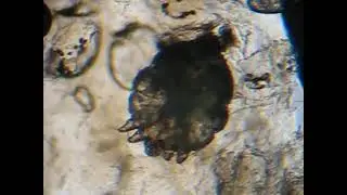 Video of a live scabies mite under a microscope