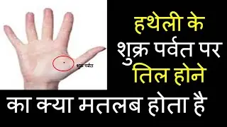 हथेली के शुक्र पर्वत पर तिल । hatheli ke Shukra parvat par til । Mole on the Venus Mount of the Palm