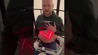 Debilitating bloating, nausea, and anxiety, corrected w lasers on gut and Vagus Nerve Stim