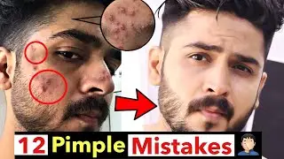 Why Your Pimples Never Go Away (12 Big Mistakes)
