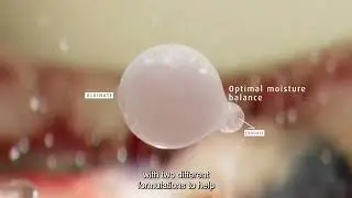 Flaminal&reg; - уникальный подход к заботе о ранах