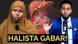 Daqtarka aya ku dhahay hadal xanuun badan inta aysan baarka matagin....