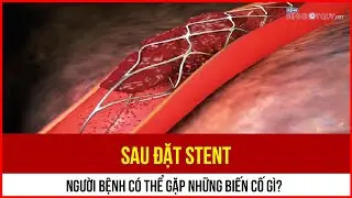 After stent placement, what complications can the patient experience?