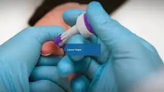 cobas b 101 Training Video   Hb1Ac test