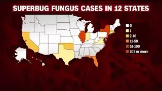 Illinois has 154 cases of potentially deadly fungal disease; 3 in St. Louis area