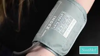 blood pressure monitor