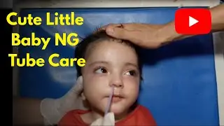 Cute Little Baby NG Tube Passing | Gentle Feeding Tube Care in NICU&rdquo;#newborncare #cute #baby #infant