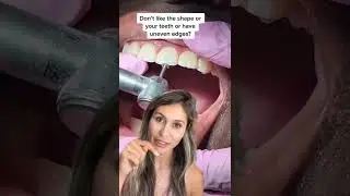 Shaping and Smoothing Teeth After Braces