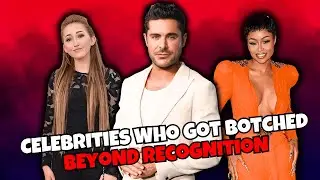 Top 10 Celebrities Who Got Botched Beyond Recognition