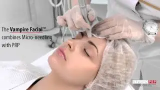Vampire Facelift PRP Studio PRP