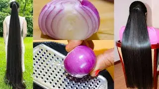प्याज में बस यह मिला लो बाल इतने लंबे मोटे हो जाएंगे कि सब चौंक जाएंगे How to grow Long Hair Fast?