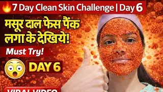 😳 Masoor Dal Face Pack 🔥 | Day 6 Clean Skin Challenge 