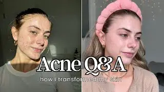 My Journey to Clear Skin | Overcoming Acne | Q&A