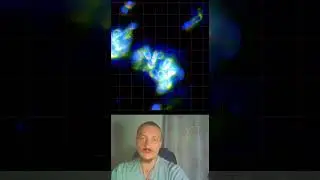 как сенная палочка подавляет грибки в кишечнике #грибок  #здоровье #кандида  #подмикроскопом