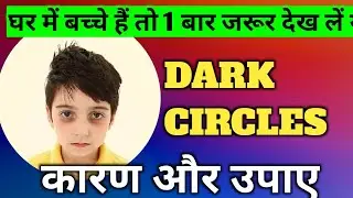 बच्चों मे आँखों के निचे काले घेरे dark circle होने की वजह और उपचार | Home remedy @DrBrajpal