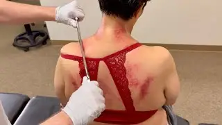 GRAINY RED BACK GETS CRUNCHED FOR THE 1ST TIME