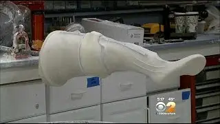 CBS2 Exclusive: Amputees Fight For Coverage In New York