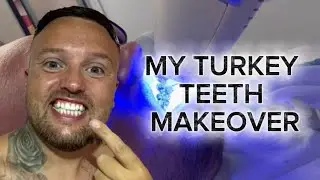 My Turkey Teeth Transformation at HDC Hisar&ouml;n&uuml;, Whitening & Smile Makeover in &Ouml;l&uuml;deniz Sep 2025