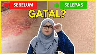 7 TANDA Kurap Kelangkang @ TINEA CRURIS!  Penyebab GATAL CELAH PAHA, Kangkang, Punggung & Kemaluan!