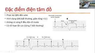 Ngoại tâm thu thất