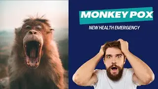 Monkey Pox- New Health Emergency?