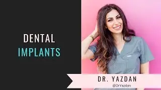 Missing teeth Replacement Options|How implants work|Dental Tips