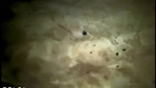 Sewer Camera Inspection - Broken Main Sewer Latteral Saddle Connection Pt.1