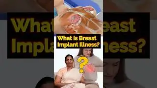 😟 What is Breast Implant Illness? 🤔 Truth You Need to Know! 💉🩺