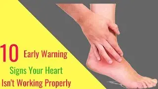 10 Early Warning Signs Your Heart Isn't Working Properly