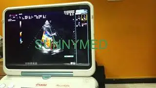 Chison Sonobook8 Cardiac Ultrasound Machine