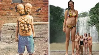 15 самых уникальных людей, которых больше одного на миллион.