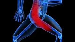 Simple Exercise Prevents Sciatica | Chiropractor Mechanicsville & Richmond VA