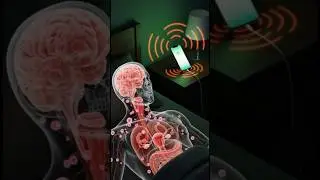 Phone Charger = CANCER + INFERTILITY? 📱 3D Medical (EMF RADIATION EXPOSED!)