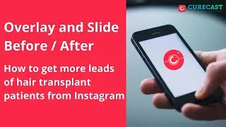 Before-After Photos Convert Patients Fast? Here's Why Doctors Are Using This