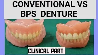 BPS DENTURE  clinical procedure part
