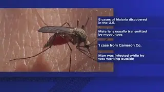 Malaria cases in Texas and Florida are the first US spread since 2003, CDC says