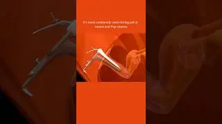 Cusco's Speculum 🤔 #share #foryou