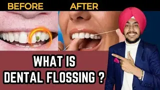 दांतो के बीच फसे खाने को कैसे निकाले ? What is Dental Flossing ? How to use Dental Flossing