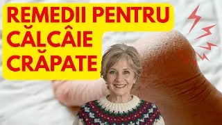 Călc&acirc;ie Crapate: 10 Remedii Naturale și Tratament Rapid Acasă 😱❤️