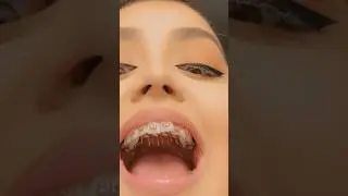 How Your Tongue Can RUIN Your Teeth! 👅🦷