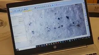 MP Filtri Patch Imaging Kit Walkthrough - Part two Portuguese version - Digital Imaging analysis