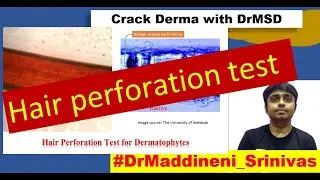 Hair perforation test | Laboratory Diagnosis of Fungus | Trichophyton Microsporum | Epidermophyton |