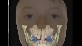3D digital diagnosis and treatment planning