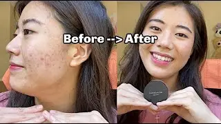 HOW TO COVER ACNE with the BareMinerals Original Powder Foundation and Look Like a Natural Beauty