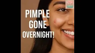1 Clove = No Pimples! Try This Overnight Beauty Hack #shorts #viralvideos