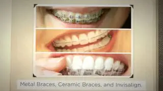 Orthodontics in Denver Provides Long-lasting Smiles for Everyone