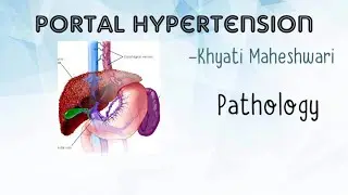 PORTAL HYPERTENSION